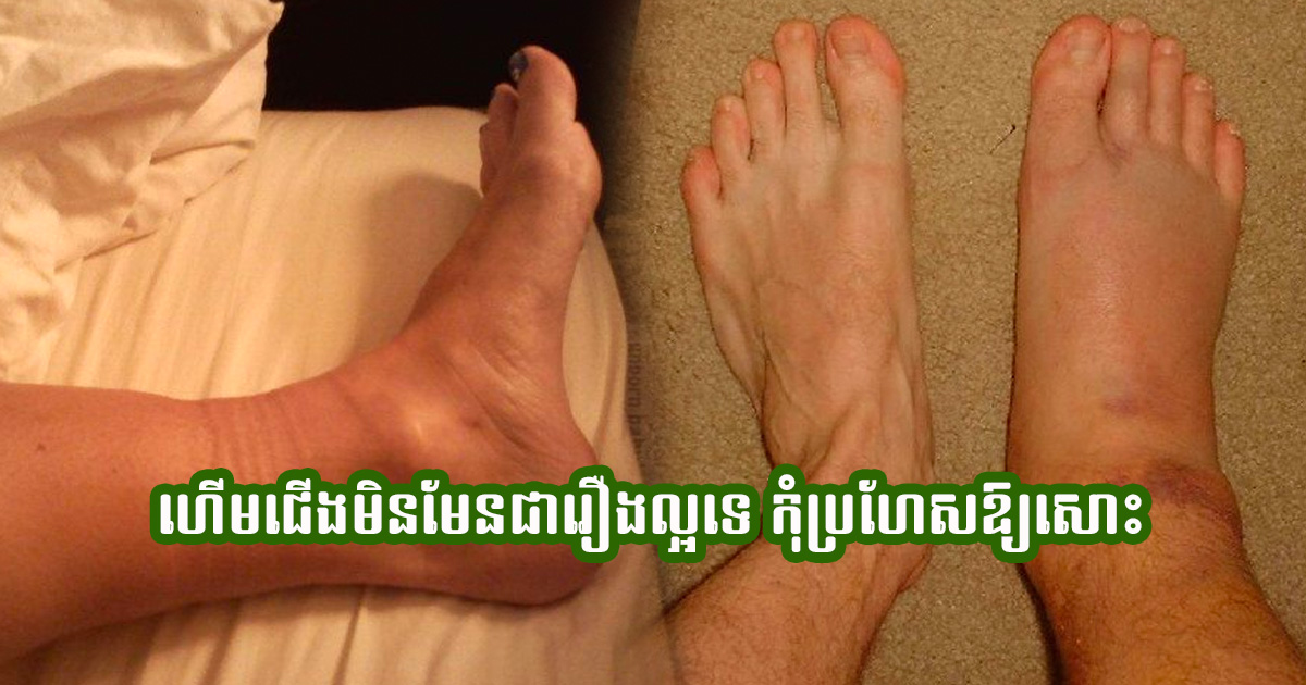 ៣