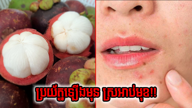 ដសដស