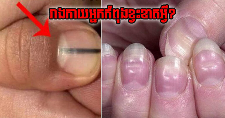 ងថថង