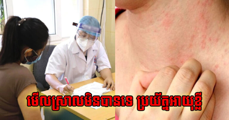Nguoi Tuoi Tho Ngan Hay Bi Ngua O 4 Vi Tri Tren Co The Gap 1 4 Diem Cung Can Kiem Tra Ngay 130216